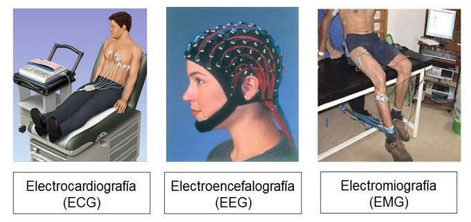 Descubre cómo funcionan los bioelectrodos, dispositivos que registran señales eléctricas del cuerpo humano para diagnóstico y monitorización.